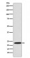PSMB8 / LMP7 antibody